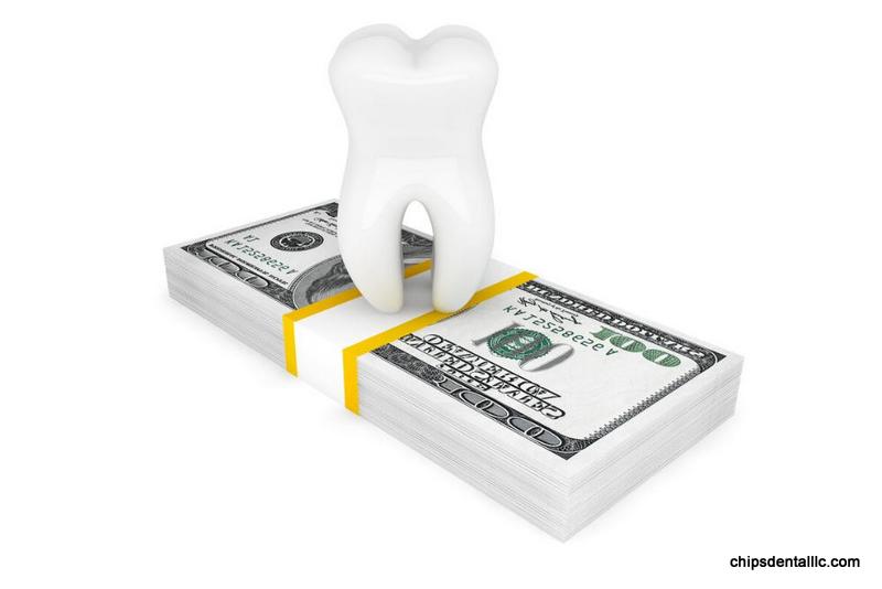 Best 5 Dental Financing Options