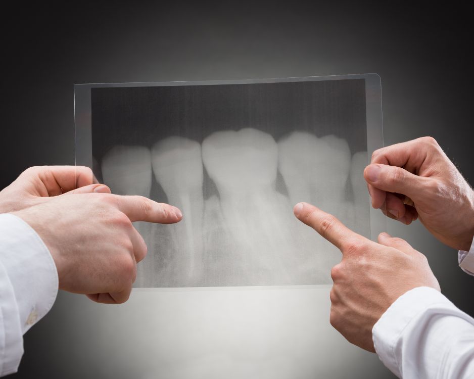 How Much Do Dental X Rays Cost Without Insurance  