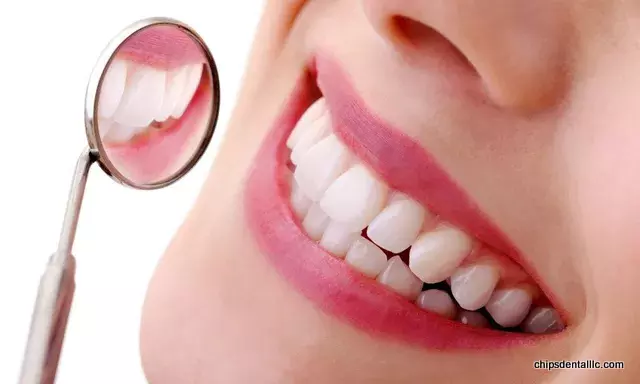 New Dental Technology for Missing Teeth